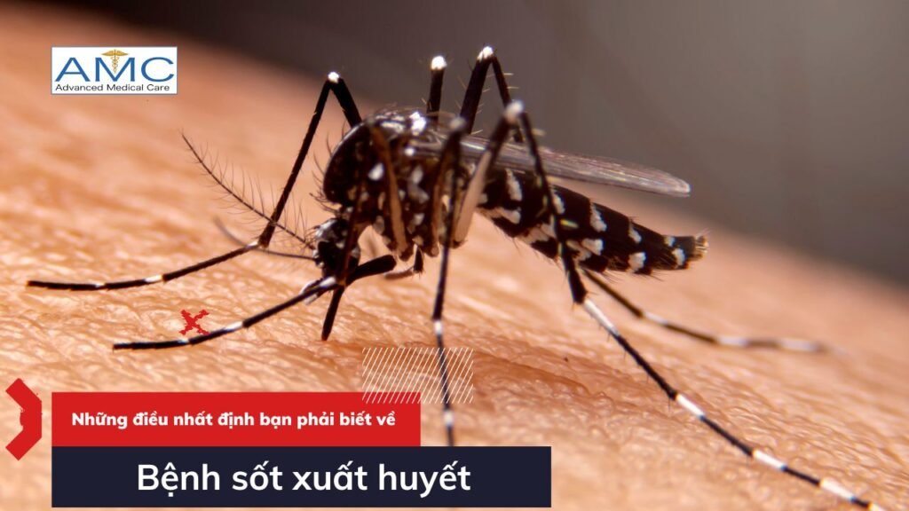 benh sot xuat huyet 1