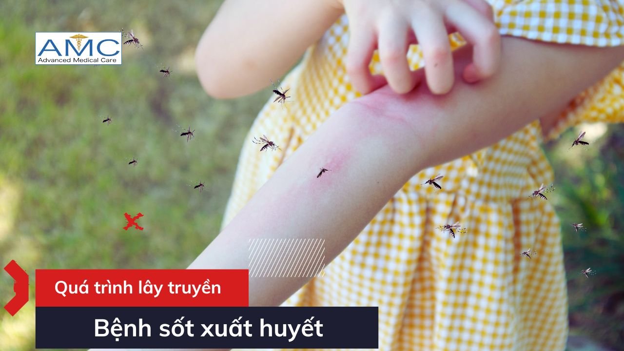 Quá trình lây truyền sốt xuất huyết Quá trình lây truyền sốt xuất huyết